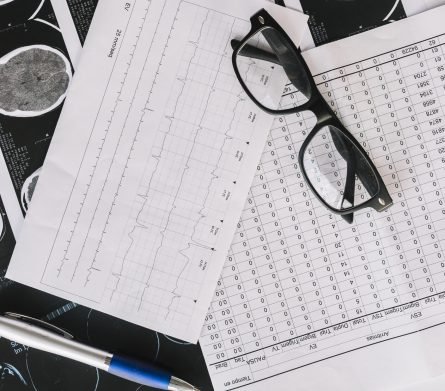 overhead-view-mri-scan-with-reports-pen-black-spectacles